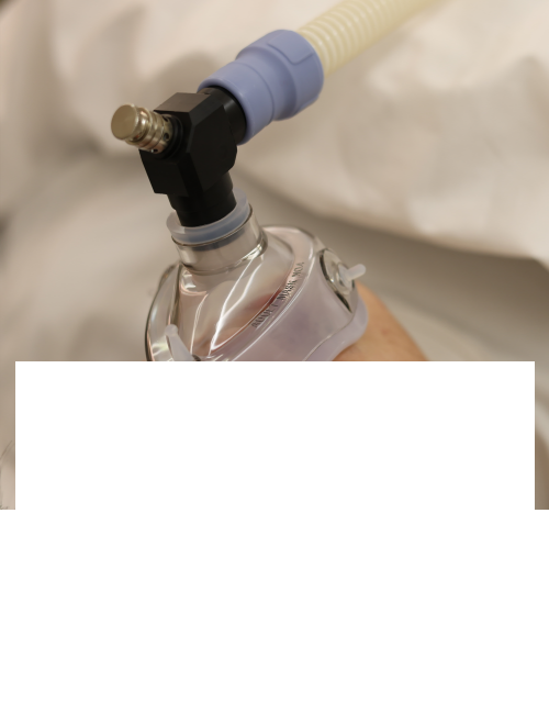 Nitrous Oxide (Laughing Gas)